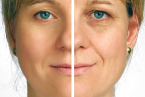 anti aging creams