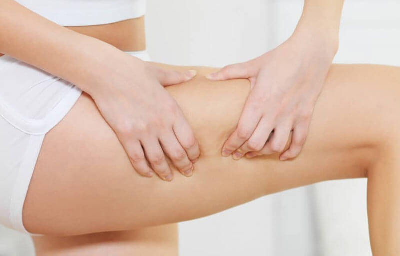 Best cellulite treatments Cellulite Cream