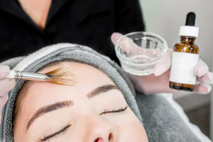 risks chemical peel