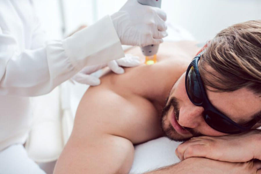 Laser hair removal men laser hair removal